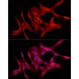 Immunofluorescence - Anti-NF-kB p65 Antibody (A309933) - Antibodies.com