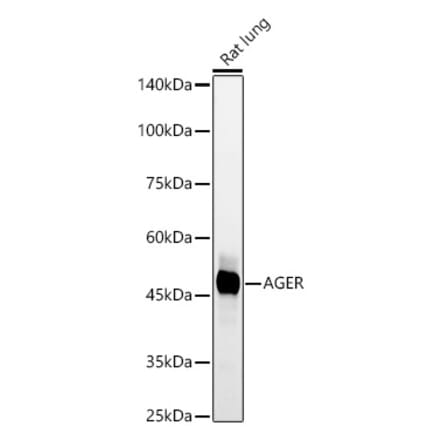 Western Blot - Anti-RAGE Antibody [ARC60991] (A309934) - Antibodies.com