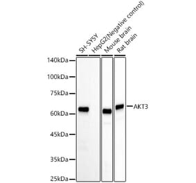 Western Blot - Anti-AKT3 Antibody [ARC57891] (A309935) - Antibodies.com