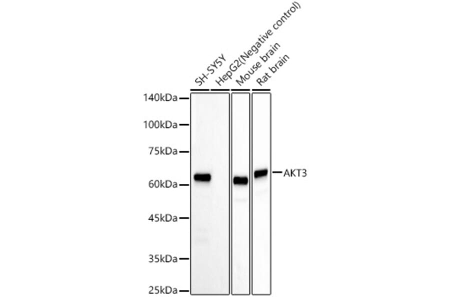 Western Blot - Anti-AKT3 Antibody [ARC57891] (A309935) - Antibodies.com