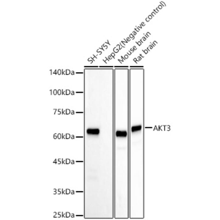 Western Blot - Anti-AKT3 Antibody [ARC57891] (A309935) - Antibodies.com