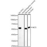 Western Blot - Anti-AKT3 Antibody [ARC57891] (A309935) - Antibodies.com