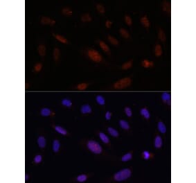 Immunofluorescence - Anti-Bcl9 Antibody (A309936) - Antibodies.com