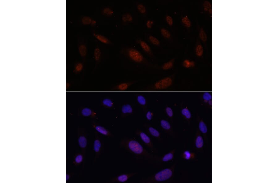 Immunofluorescence - Anti-Bcl9 Antibody (A309936) - Antibodies.com