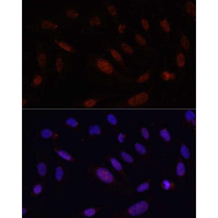 Immunofluorescence - Anti-Bcl9 Antibody (A309936) - Antibodies.com