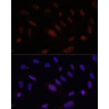 Immunofluorescence - Anti-Bcl9 Antibody (A309936) - Antibodies.com