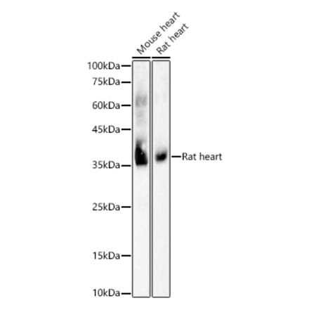 Western Blot - Anti-MTCO1 Antibody [ARC59830] (A309938) - Antibodies.com