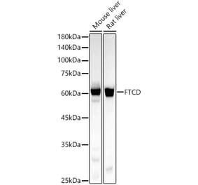 Western Blot - Anti-58K Golgi protein Antibody [ARC58234] (A309940) - Antibodies.com