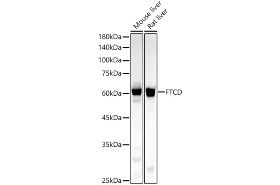 Western Blot - Anti-58K Golgi protein Antibody [ARC58234] (A309940) - Antibodies.com