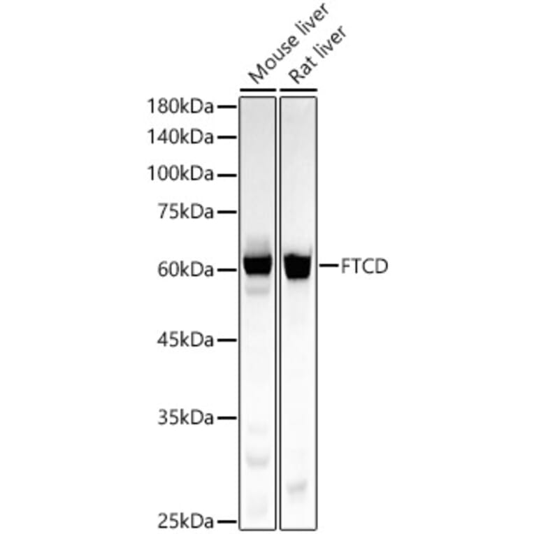 Western Blot - Anti-58K Golgi protein Antibody [ARC58234] (A309940) - Antibodies.com