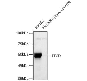 Western Blot - Anti-58K Golgi protein Antibody [ARC58229 + ARC58234] (A309942) - Antibodies.com