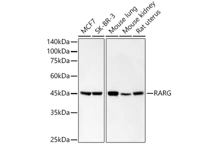 Western Blot - Anti-Retinoic Acid Receptor gamma Antibody [ARC59266] (A309952) - Antibodies.com