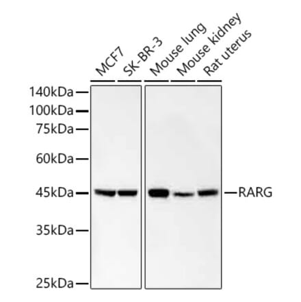 Western Blot - Anti-Retinoic Acid Receptor gamma Antibody [ARC59266] (A309952) - Antibodies.com