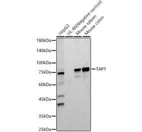 Western Blot - Anti-TAP1 Antibody [ARC59005] (A309954) - Antibodies.com