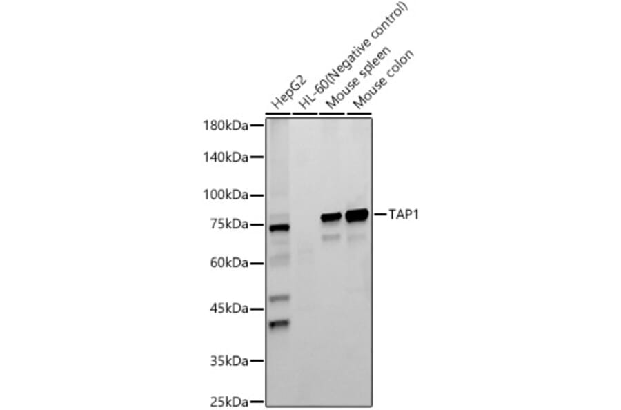 Western Blot - Anti-TAP1 Antibody [ARC59005] (A309954) - Antibodies.com