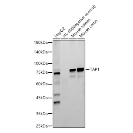 Western Blot - Anti-TAP1 Antibody [ARC59005] (A309954) - Antibodies.com