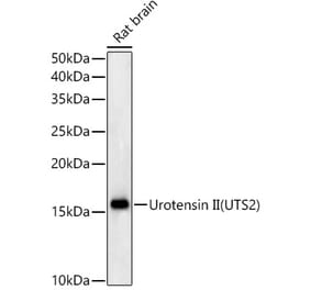 Western Blot - Anti-Urotensin II Antibody [ARC59263] (A309958) - Antibodies.com
