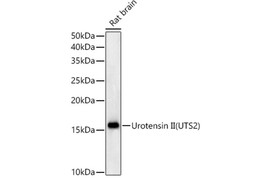 Western Blot - Anti-Urotensin II Antibody [ARC59263] (A309958) - Antibodies.com