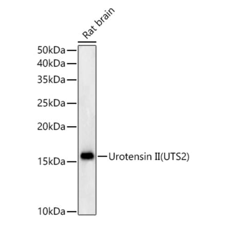 Western Blot - Anti-Urotensin II Antibody [ARC59263] (A309958) - Antibodies.com