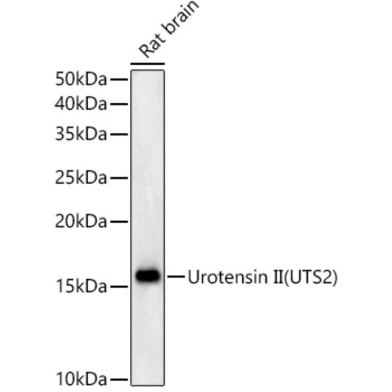 Western Blot - Anti-Urotensin II Antibody [ARC59263] (A309958) - Antibodies.com