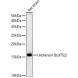 Western Blot - Anti-Urotensin II Antibody [ARC59263] (A309958) - Antibodies.com