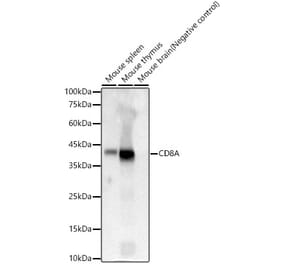 Western Blot - Anti-CD8 alpha Antibody [ARC59319] (A309962) - Antibodies.com