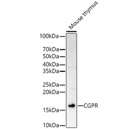 Western Blot - Anti-CGRP Antibody (A309964) - Antibodies.com