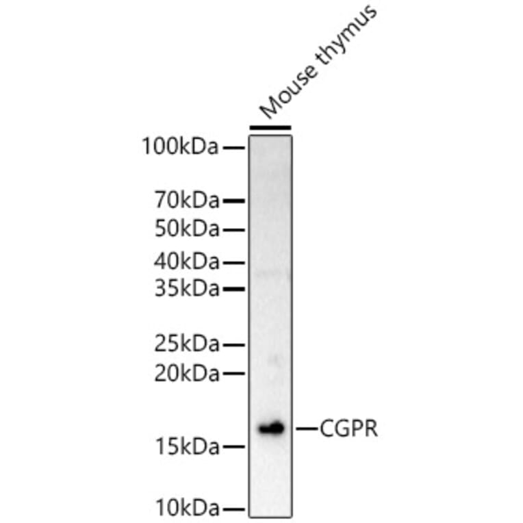 Western Blot - Anti-CGRP Antibody (A309964) - Antibodies.com