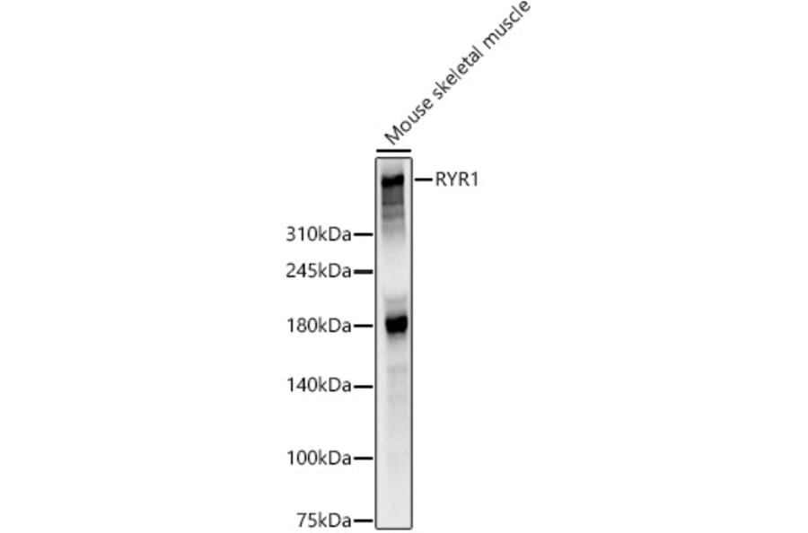 Western Blot - Anti-Ryanodine Receptor Antibody (A309967) - Antibodies.com