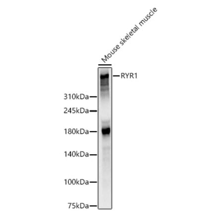 Western Blot - Anti-Ryanodine Receptor Antibody (A309967) - Antibodies.com
