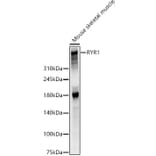 Western Blot - Anti-Ryanodine Receptor Antibody (A309967) - Antibodies.com