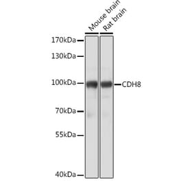 Western Blot - Anti-Cadherin 8 Antibody (A309969) - Antibodies.com
