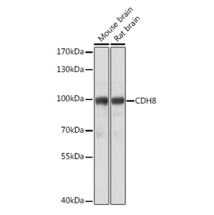 Western Blot - Anti-Cadherin 8 Antibody (A309969) - Antibodies.com