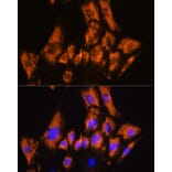 Immunofluorescence - Anti-Cadherin 8 Antibody (A309969) - Antibodies.com