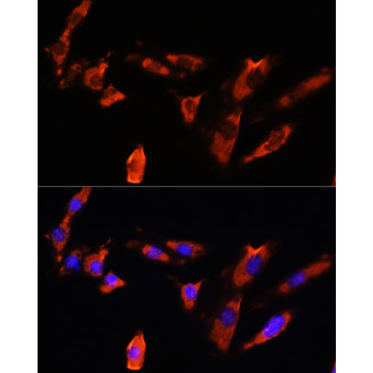 Immunofluorescence - Anti-Cadherin 8 Antibody (A309969) - Antibodies.com