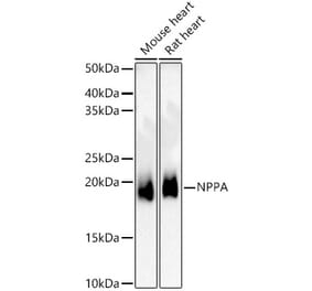 Western Blot - Anti-Natriuretic peptides A Antibody (A309971) - Antibodies.com