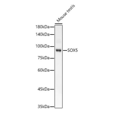 Western Blot - Anti-SOX5 Antibody [ARC58747] (A309972) - Antibodies.com