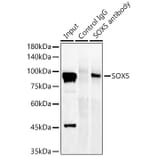 Western Blot - Anti-SOX5 Antibody [ARC58747] (A309972) - Antibodies.com