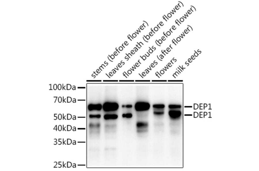 Western Blot - Anti-DEP1 Antibody (A309977) - Antibodies.com