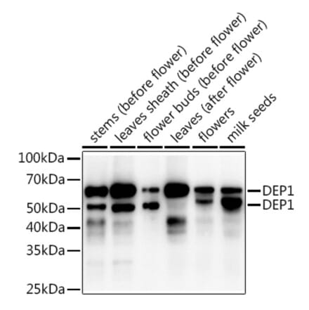 Western Blot - Anti-DEP1 Antibody (A309977) - Antibodies.com