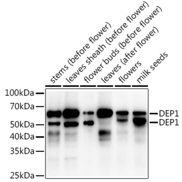 Western Blot - Anti-DEP1 Antibody (A309977) - Antibodies.com