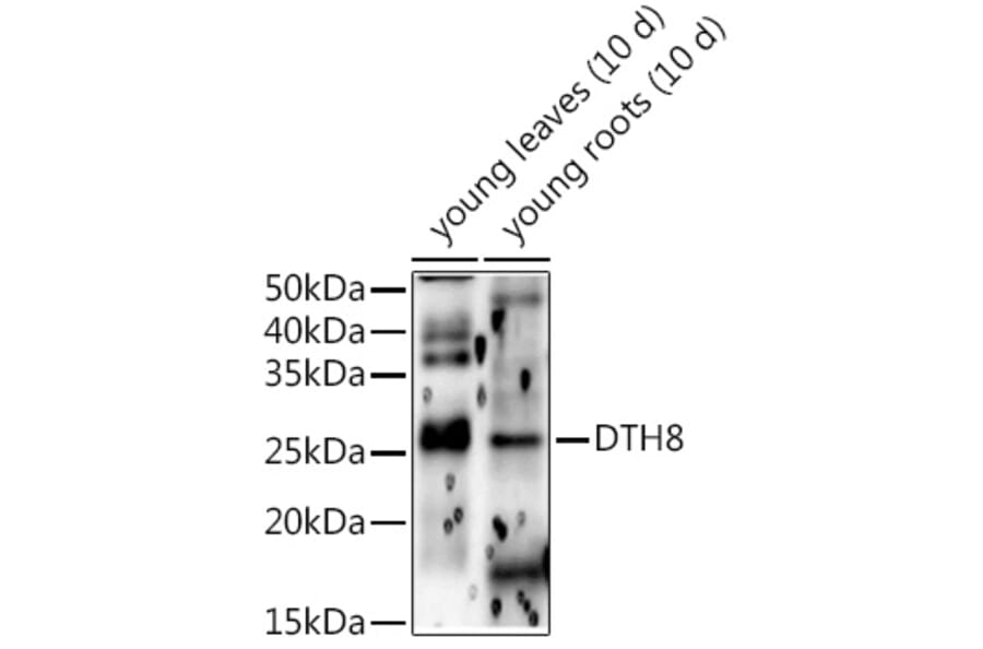 Western Blot - Anti-HD5 Antibody (A309978) - Antibodies.com
