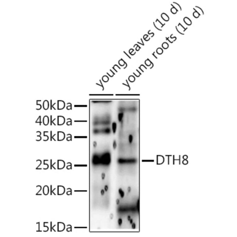 Western Blot - Anti-HD5 Antibody (A309978) - Antibodies.com