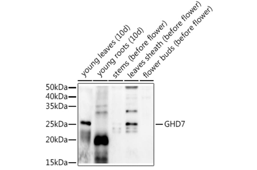 Western Blot - Anti-GHD7 Antibody (A309981) - Antibodies.com