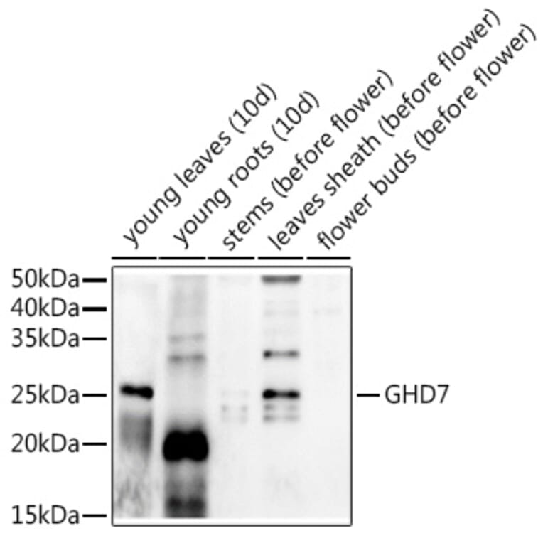Western Blot - Anti-GHD7 Antibody (A309981) - Antibodies.com