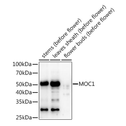 Western Blot - Anti-MOC1 Antibody (A309989) - Antibodies.com