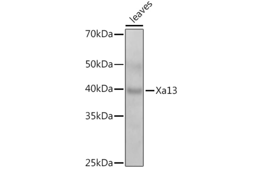 Western Blot - Anti-SWEET11 Antibody (A309997) - Antibodies.com
