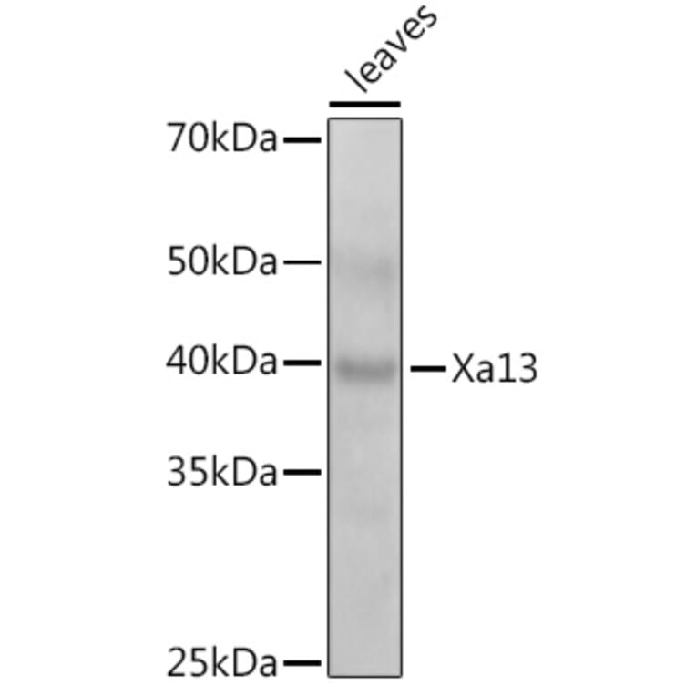 Western Blot - Anti-SWEET11 Antibody (A309997) - Antibodies.com