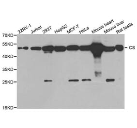 Anti-CS Antibody from Bioworld Technology (BS7809) - Antibodies.com