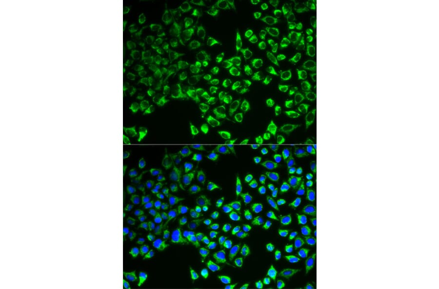Anti-CS Antibody from Bioworld Technology (BS7809) - Antibodies.com